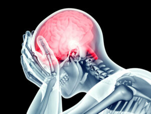 x-ray image human head with pain